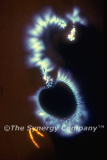 Kirlian Image